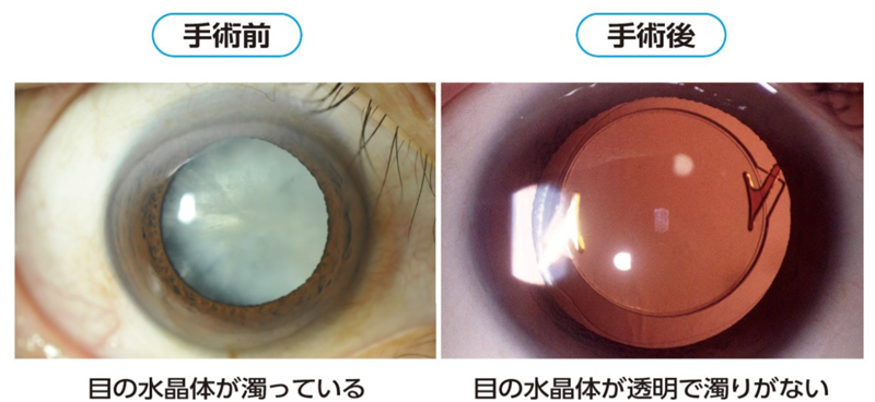 どのような運動をすれば大丈夫でしょうか？